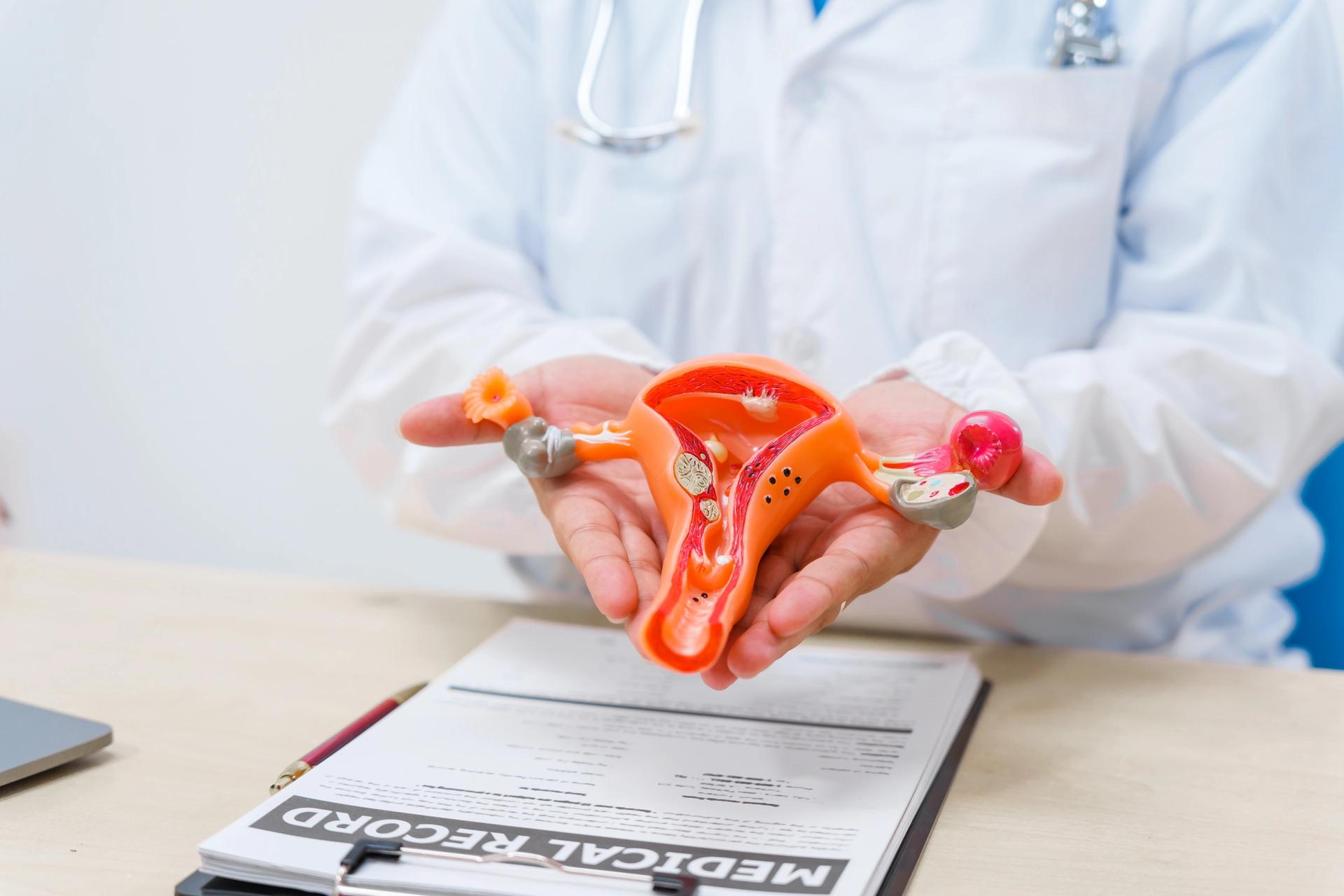 A doctor holding a female reproductive system model. Medical concept related to urogynecology examination and women's health