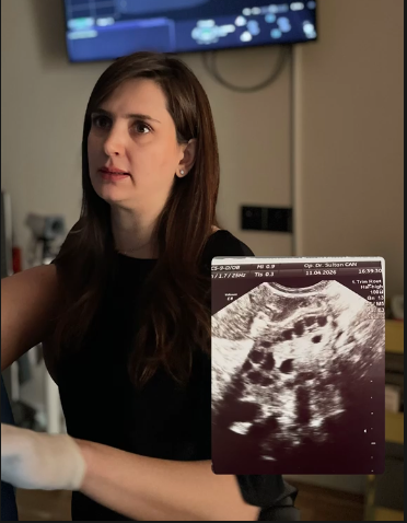 PKOS (PCOS/PMOS) Tedavisi ve Takibi
